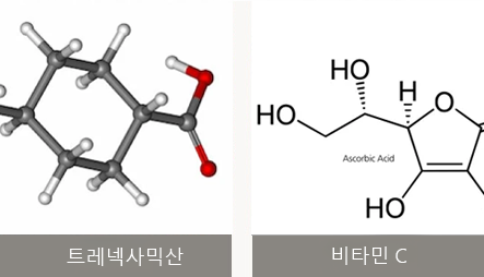 시술 전 / 시술 4주 후