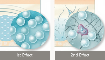 시술 전 / 시술 직후