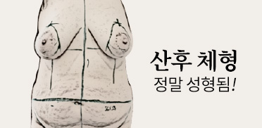 산후 체형 정말 성형됨!