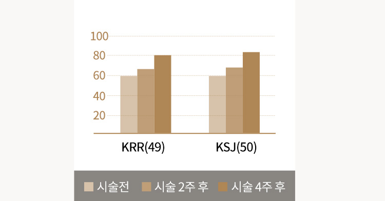 시술 효과 지속 기간